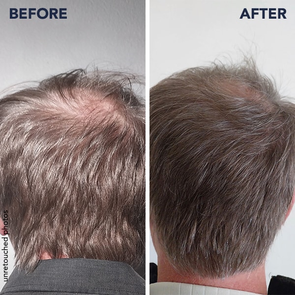 100% DE SATISFACCIÓN